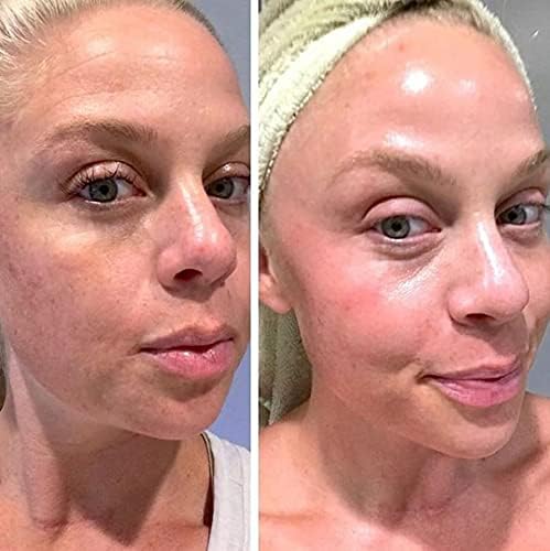 Retinol Gel 0.1% – Vitamin A Night Treatment