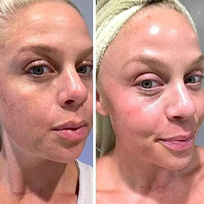 Retinol Gel 0.1% – Vitamin A Night Treatment